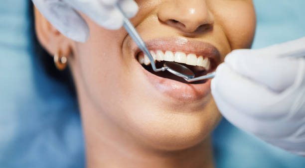 Best Emergency Treatment for Dental Infections or Abscesses in Holiday Valley, OH