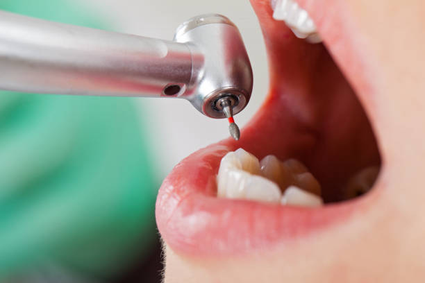 Best Emergency Treatment for Dental Infections or Abscesses in Holiday Valley, OH